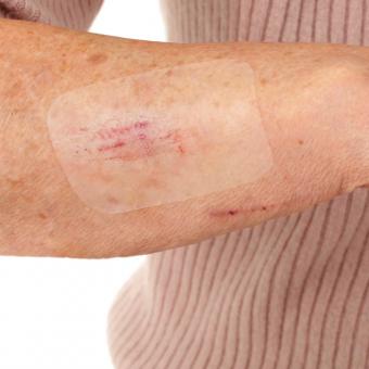 Leukomed T skin sensitive - 7,2x5cm, steril