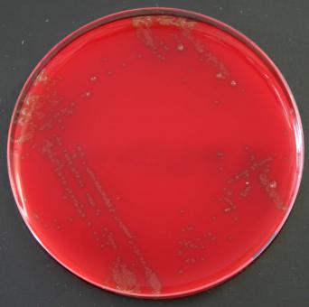 Columbia-Agar mit Schafsblut PLUS