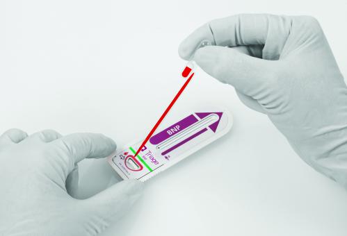 Triage® Pipetten