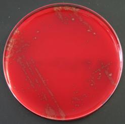 Columbia-Agar mit Schafsblut PLUS 