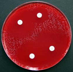 Mueller-Hinton - Agar mit 5% Schafsblut 